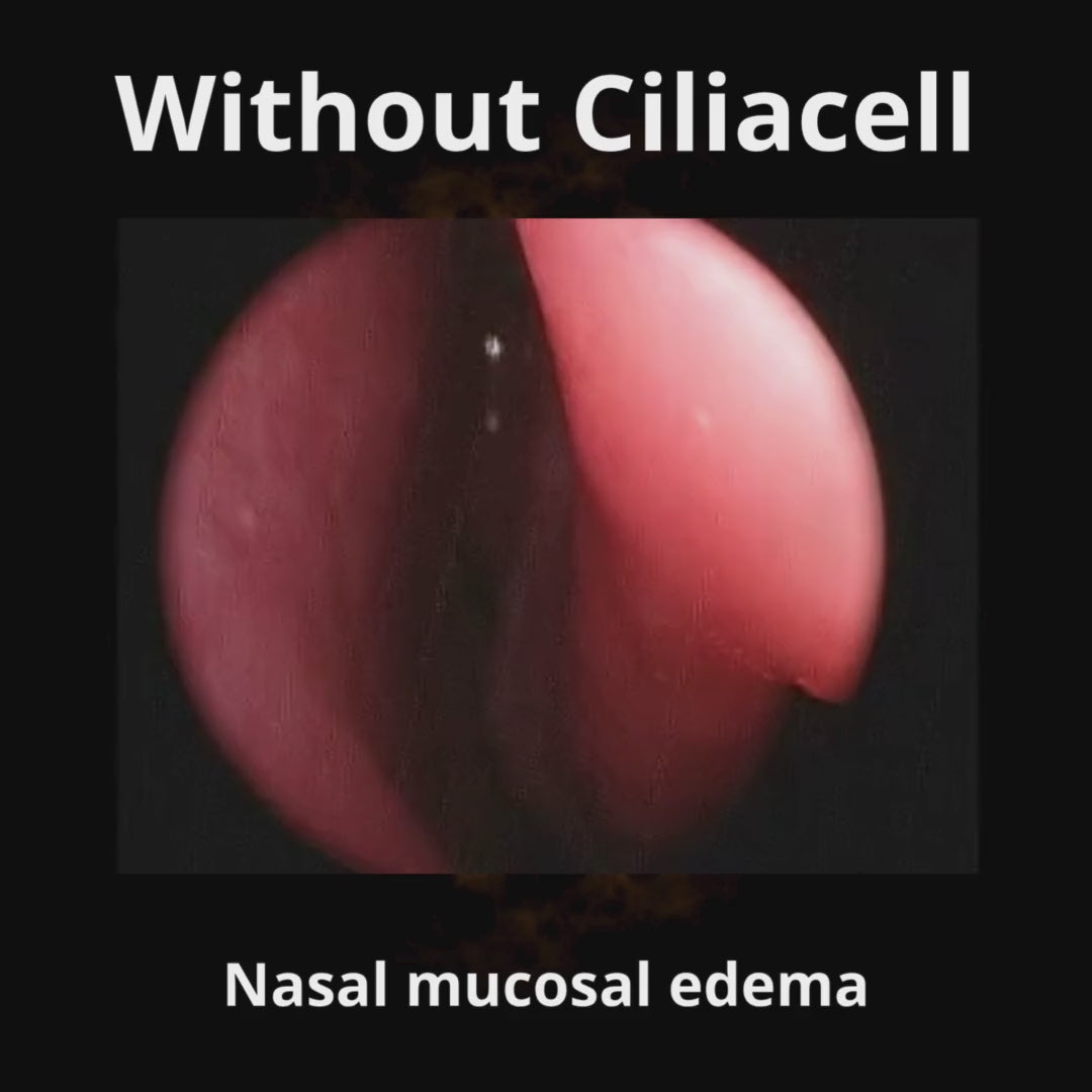 Carica video: CiliaCell Spray Nasale - Adulti SENSITIVE