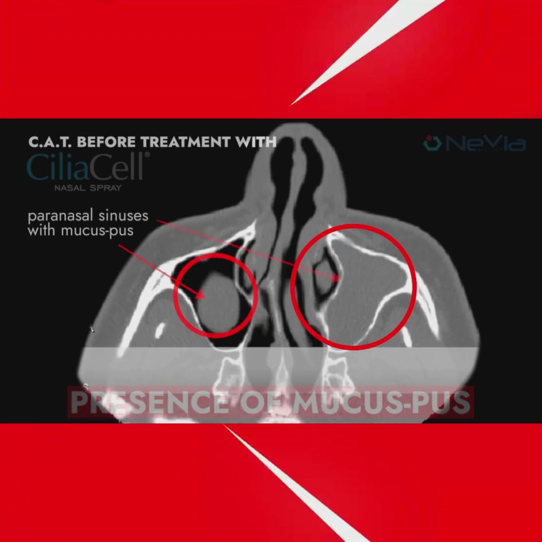 Carica video: CiliaCell Spray Nasale - Adulti SENSITIVE